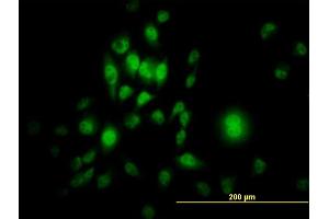 Immunofluorescence of monoclonal antibody to SP1 on HeLa cell. (SP1 anticorps  (AA 89-198))