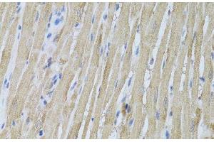 Immunohistochemistry of paraffin-embedded Rat heart using P2RY2 Polyclonal Antibody at dilution of 1:100 (40x lens). (P2RY2 anticorps)