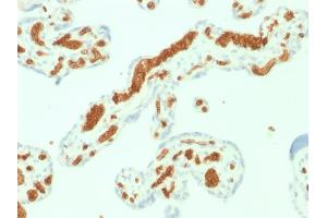 Formalin-fixed, paraffin-embedded human Placenta stained with Spectrin alpha 1 (SPTA1) Mouse Monoclonal Antibody (SPTA1/1832).