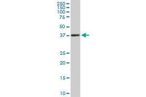 PCYT1A monoclonal antibody (M03), clone 7H8. (PCYT1A anticorps  (AA 2-90))