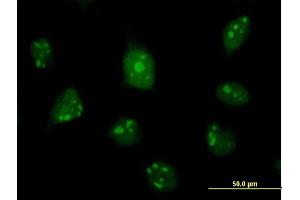 Immunofluorescence of purified MaxPab antibody to C1D on HeLa cell. (C1D anticorps  (AA 1-141))