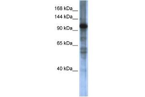 WB Suggested Anti-SMARCAL1 Antibody Titration:  0. (SMARCAL1 anticorps  (Middle Region))
