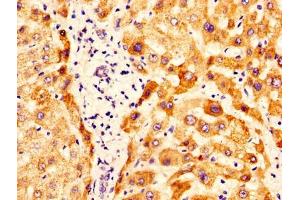 IHC image of ABIN7162288 diluted at 1:400 and staining in paraffin-embedded human liver tissue performed on a Leica BondTM system.