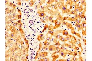 IHC image of ABIN7162288 diluted at 1:400 and staining in paraffin-embedded human liver tissue performed on a Leica BondTM system. (OTC anticorps  (AA 33-354))