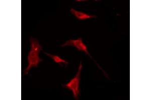 ABIN6274584 staining HuvEc by IF/ICC.