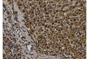 ABIN6276971 at 1/100 staining Human liver tissue by IHC-P. (FE65 anticorps  (C-Term))