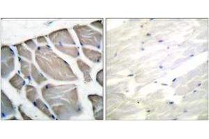 Immunohistochemistry analysis of paraffin-embedded human skeletal muscle tissue, using Actin-pan Antibody.