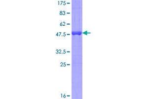 Image no. 1 for Mediator Complex Subunit 9 (MED9) (AA 1-146) protein (GST tag) (ABIN1310681)