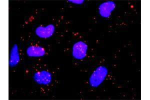 Proximity Ligation Analysis of protein-protein interactions between HIP1 and CLTC.
