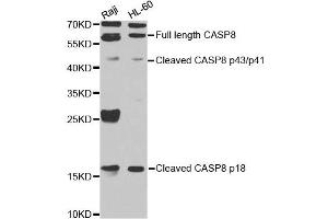 Western blot analysis of extracts of Raji cell and HL-60 cell line, using CASP8 antibody. (Caspase 8 anticorps)