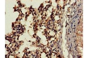 Immunohistochemistry of paraffin-embedded human lung tissue using ABIN7164288 at dilution of 1:100