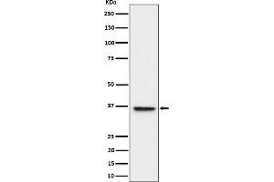 Western blot analysis of ULBP1 expression in HeLa cell lysate.