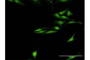Immunofluorescence of purified MaxPab antibody to SNCG on HeLa cell.