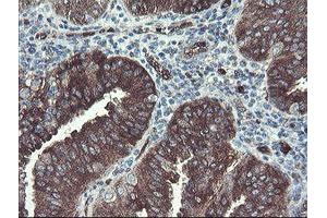 Image no. 5 for anti-TSC22 Domain Family, Member 1 (TSC22D1) antibody (ABIN1501540) (TSC22D1 anticorps)