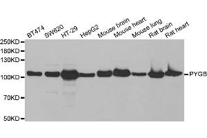 Western blot analysis of extracts of various cell lines, using PYGB antibody (ABIN5973803) at 1/1000 dilution.