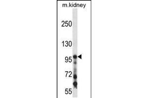 Western blot analysis in mouse kidney tissue lysates (35ug/lane).