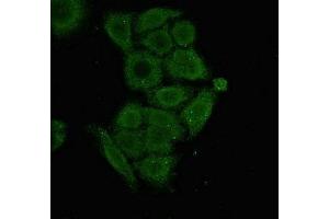 Immunofluorescent analysis of PC-3 cells using ABIN7166156 at dilution of 1:100 and Alexa Fluor 488-congugated AffiniPure Goat Anti-Rabbit IgG(H+L) (SSX1 anticorps  (AA 112-188))