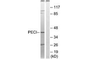 Western blot analysis of extracts from 293 cells, using PECI Antibody. (PECI/ECI2 anticorps  (AA 73-122))