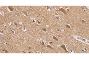Immunohistochemistry of paraffin-embedded Human brain tissue using RAB6C Polyclonal Antibody at dilution 1:45 (WTH3DI anticorps)