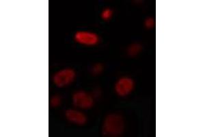 ABIN6274327 staining HuvEc cells by IF/ICC. (Nuclear Factor 1 anticorps)