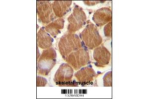 ASAM Antibody immunohistochemistry analysis in formalin fixed and paraffin embedded human skeletal muscle followed by peroxidase conjugation of the secondary antibody and DAB staining. (CLMP anticorps  (AA 81-110))