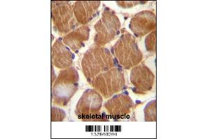 ASAM Antibody immunohistochemistry analysis in formalin fixed and paraffin embedded human skeletal muscle followed by peroxidase conjugation of the secondary antibody and DAB staining.