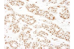 Immunohistochemistry (IHC) image for anti-KH-Type Splicing Regulatory Protein (KHSRP) (AA 660-710) antibody (ABIN7454427)