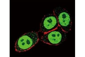 Confocal immunofluorescent analysis of SMAD3 antibody with HeLa cells followed by Alexa Fluor 488-conjugated goat anti-rabbit lgG (green).
