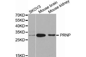 Western blot analysis of extracts of various cell lines, using PRNP antibody (ABIN5971407) at 1/1000 dilution. (PRNP anticorps)