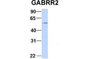 Host:  Rabbit  Target Name:  GABRR2  Sample Type:  293T  Antibody Dilution:  1. (GABRR2 anticorps  (Middle Region))