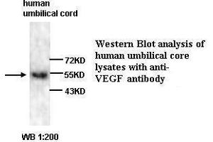 Western Blotting (WB) image for anti-Vascular Endothelial Growth Factor A (VEGFA) antibody (ABIN6583751) (VEGFA anticorps)
