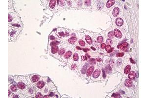 Anti-H3F3B antibody IHC of human prostate.