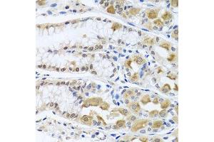 Immunohistochemistry of paraffin-embedded human stomach using TRMT1 antibody.