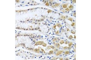 Immunohistochemistry of paraffin-embedded human stomach using TRMT1 antibody. (TRMT1 anticorps  (AA 460-659))