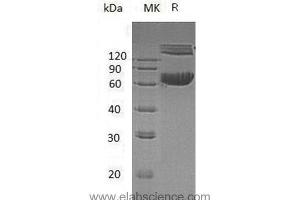 Western Blotting (WB) image for Ephrin B1 (EFNB1) protein (His tag,Fc Tag) (ABIN7320516)