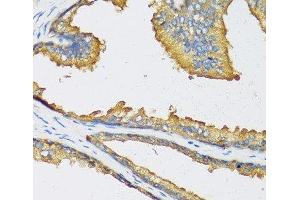 Immunohistochemistry of paraffin-embedded Human prostate using CXCL11 Polyclonal Antibody at dilution of 1:100 (40x lens).