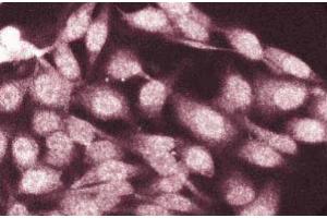 Immunofluorescence staining of HeLa cells.