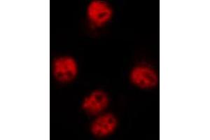 ABIN6267330 staining 293 by IF/ICC.