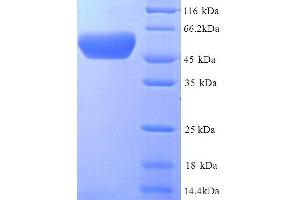 Serine Endoprotease (Protease Do), Membrane-Associated (DEGP) (AA 27-474), (full length) protein (His tag) (DEGP Protein (AA 27-474, full length) (His tag))