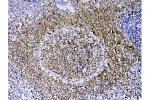 IHC analysis of PAX5 using anti-PAX5 antibody .