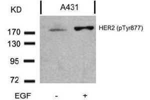 Image no. 3 for anti-Receptor tyrosine-protein kinase erbB-2 (ErbB2/Her2) (pTyr877) antibody (ABIN196748) (ErbB2/Her2 anticorps  (pTyr877))