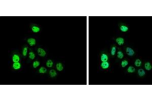 ICC/IF Image CDCA1 antibody [GT312] detects CDCA1 protein at cytoplasm and nucleus by immunofluorescent analysis. (NUF2 anticorps)