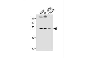 All lanes : Anti-N6T1 Antibody (N-term) at 1:2000 dilution Lane 1: K562 whole cell lysate Lane 2: SH-SY5Y whole cell lysate Lane 3: U-2OS whole cell lysate Lysates/proteins at 20 μg per lane. (N6AMT1 anticorps  (N-Term))