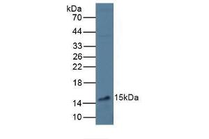 Western blot analysis of Mouse Liver Tissue. (VEGFA anticorps  (AA 28-191))