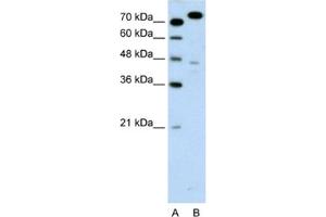 Western Blotting (WB) image for anti-Minichromosome Maintenance Complex Component 3 (MCM3) antibody (ABIN2461390) (MCM3 anticorps)