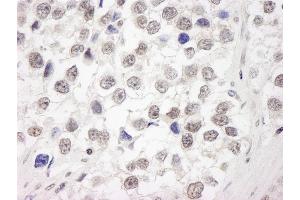 Immunohistochemistry (IHC) image for anti-Ubiquitin Interaction Motif Containing 1 (UIMC1) (C-Term) antibody (ABIN7449010) (UIMC1 anticorps  (C-Term))
