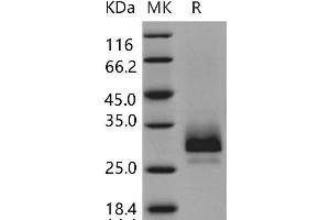 Western Blotting (WB) image for Tissue Factor Pathway Inhibitor 2 (TFPI2) protein (His tag) (ABIN7320074)