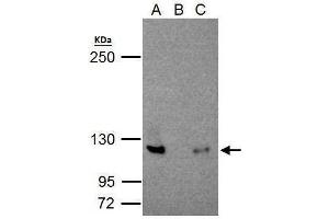 IP Image NFkB p100/p52 antibody immunoprecipitates NFkB p100/p52 protein in IP experiments.
