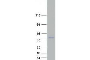 Validation with Western Blot