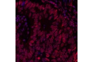 Immunofluorescence (IF) image for anti-Bromodomain Containing 3 (BRD3) (AA 676-726) antibody (ABIN7455203) (Recombinant BRD3 anticorps  (AA 676-726))